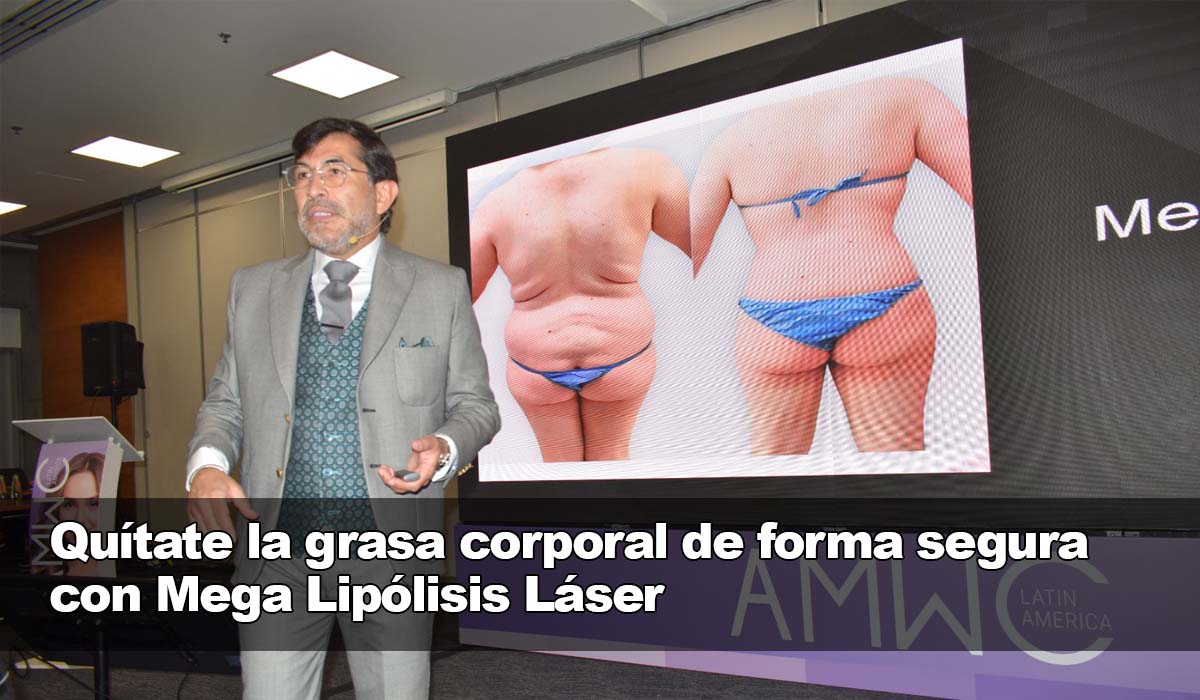 Eliminación segura y efectiva de la grasa corporal con Mega Lipólisis Láser